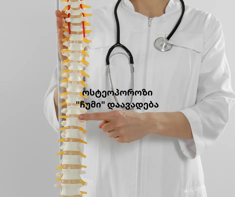 osteoporozi-ukhilavi-safrtkhe-romelits-tqvens-dzvlebs-emuqreba